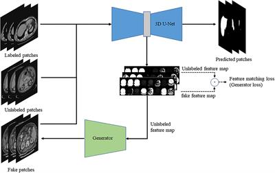 Three-Dimensional Liver Image Segmentation Using Generative Adversarial Networks Based on Feature Restoration